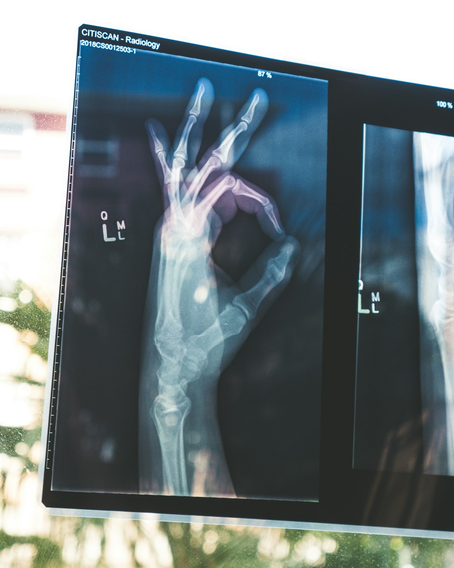 Unlocking Potential With Advanced Process Automation